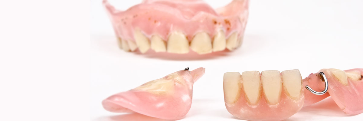 Los Angeles What Do I Do If I Damage My Dentures?