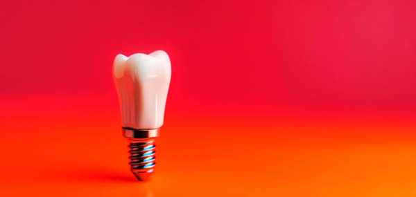 Recovering From Getting Dental Implants