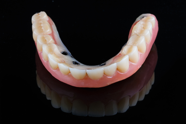 Are Implant Supported Dentures Better Than Traditional Dentures?