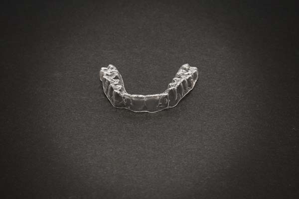 What To Discuss At A Dental Consultation About Invisalign