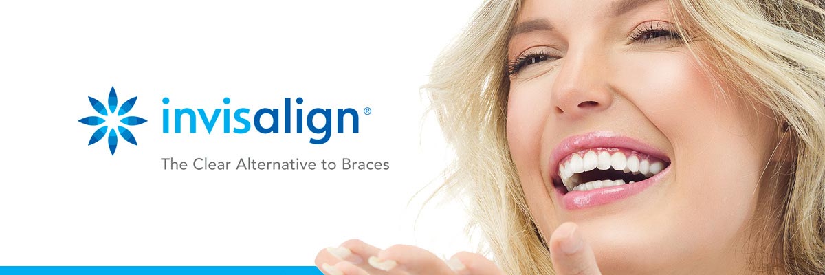 Los Angeles Invisalign