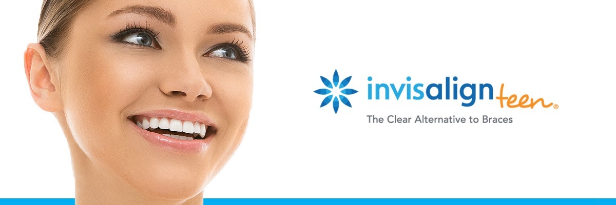 Los Angeles Invisalign vs Traditional Braces