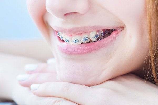 Bite Complications That Orthodontic Treatment Can Fix