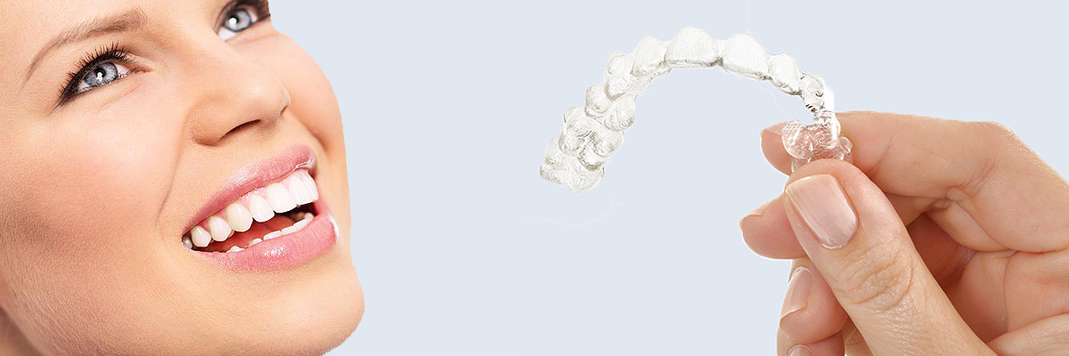Los Angeles 7 Things Parents Need to Know About Invisalign Teen