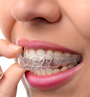 Clear Aligners - Almost Invisible Braces Los Angeles, CA
