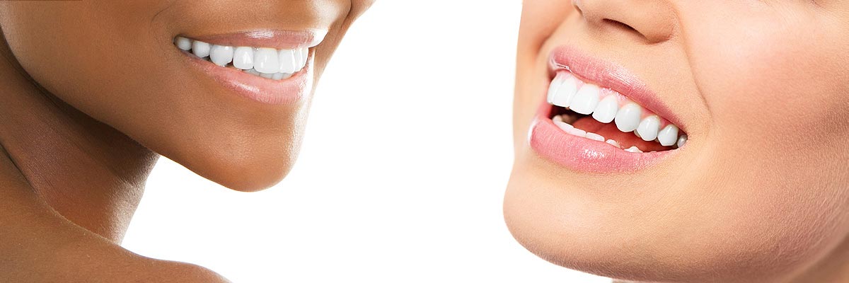 Los Angeles Teeth Whitening